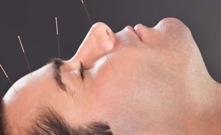  Why is Acupuncture Good for You